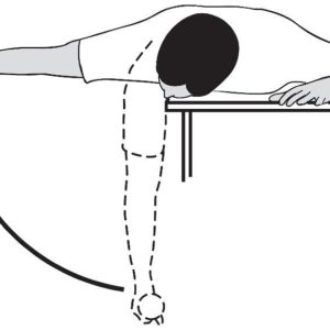 آسيب شانه يخ زده و موارد اصلاح آن